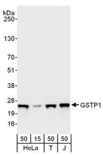 GSTP1 Antibody in Western Blot (WB)