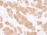 COMT Antibody in Immunohistochemistry (Paraffin) (IHC (P))