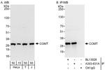 COMT Antibody in Western Blot (WB)