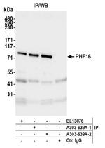 PHF16 Antibody in Immunoprecipitation (IP)