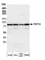 PHF16 Antibody in Western Blot (WB)