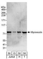 Myoneurin Antibody in Western Blot (WB)