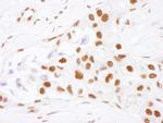 NF90 Antibody in Immunohistochemistry (Paraffin) (IHC (P))