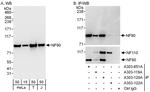 NF90 Antibody in Western Blot (WB)