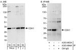 CDK1 Antibody in Western Blot (WB)