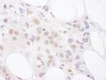 U2AF65 Antibody in Immunohistochemistry (Paraffin) (IHC (P))