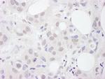 U2AF65 Antibody in Immunohistochemistry (Paraffin) (IHC (P))