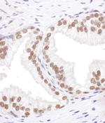 SRp55 Antibody in Immunohistochemistry (Paraffin) (IHC (P))