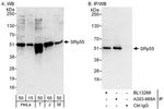 SRp55 Antibody in Western Blot (WB)