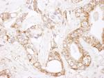 Bcl-2 Antibody in Immunohistochemistry (Paraffin) (IHC (P))