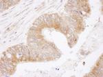 Bcl-2 Antibody in Immunohistochemistry (Paraffin) (IHC (P))