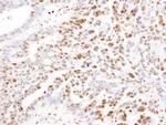 SAMHD1 Antibody in Immunohistochemistry (Paraffin) (IHC (P))