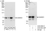 SAMHD1 Antibody in Western Blot (WB)