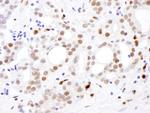 SAMHD1 Antibody in Immunohistochemistry (Paraffin) (IHC (P))