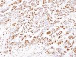 SAMHD1 Antibody in Immunohistochemistry (Paraffin) (IHC (P))