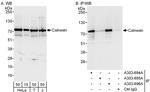 Calnexin Antibody in Western Blot (WB)