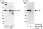 CDC40 Antibody in Western Blot (WB)