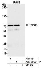 ZBTB7B Antibody in Immunoprecipitation (IP)