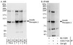 Insulin Receptor Beta Antibody in Western Blot (WB)