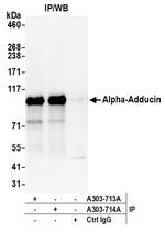 Alpha-Adducin Antibody in Immunoprecipitation (IP)