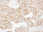 Alpha-Adducin Antibody in Immunohistochemistry (Paraffin) (IHC (P))