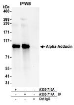 Alpha-Adducin Antibody in Immunoprecipitation (IP)