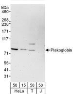 Plakoglobin Antibody in Western Blot (WB)