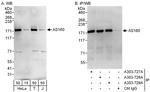 AS160 Antibody in Western Blot (WB)