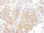 AS160 Antibody in Immunohistochemistry (Paraffin) (IHC (P))