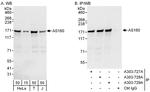 AS160 Antibody in Western Blot (WB)