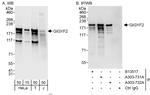 GIGYF2 Antibody in Western Blot (WB)