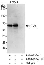 ETV3 Antibody in Immunoprecipitation (IP)