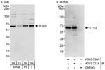 ETV3 Antibody in Western Blot (WB)