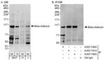 Beta-Adducin Antibody in Western Blot (WB)