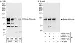 Beta-Adducin Antibody in Western Blot (WB)