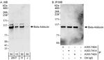 Beta-Adducin Antibody in Western Blot (WB)