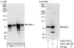 IRAK1 Antibody in Western Blot (WB)