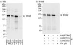 DSG2 Antibody in Western Blot (WB)