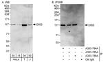 DIS3 Antibody in Western Blot (WB)