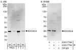 EXOSC4 Antibody in Western Blot (WB)