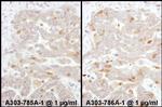 Beta-Arrestin 2 Antibody in Immunohistochemistry (Paraffin) (IHC (P))