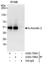 Beta-Arrestin 2 Antibody in Immunoprecipitation (IP)