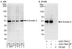 Beta-Arrestin 2 Antibody in Western Blot (WB)