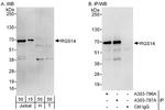 RGS14 Antibody in Western Blot (WB)