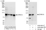 DYRK1A Antibody in Western Blot (WB)