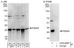 PSMA6 Antibody in Western Blot (WB)