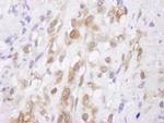 SOD1 Antibody in Immunohistochemistry (Paraffin) (IHC (P))