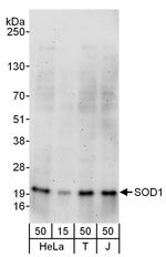 SOD1 Antibody in Western Blot (WB)