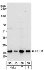 SOD1 Antibody in Western Blot (WB)