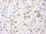 PSMC1 Antibody in Immunohistochemistry (Paraffin) (IHC (P))